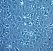 MEC1 Mouse Embryonic Epicardial Cell Line MEC1 mouse embryonic epicardial cell line is a useful model for cardiac developmental biology studies.