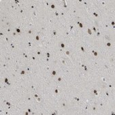 Anti-SMARCAD1 antibody produced in rabbit Prestige Antibodies® Powered by Atlas Antibodies, affinity isolated antibody, buffered aqueous glycerol solution