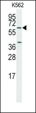 Anti-WIF1 (N-term) antibody produced in rabbit affinity isolated antibody, buffered aqueous solution