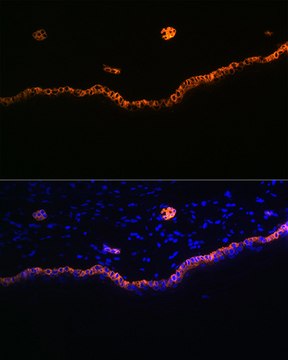 Anti-Cytokeratin 15 (KRT15) Antibody, clone 9F9F0, Rabbit Monoclonal