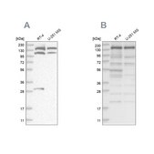 Anti-PDS5A antibody produced in rabbit Prestige Antibodies® Powered by Atlas Antibodies, affinity isolated antibody, buffered aqueous glycerol solution