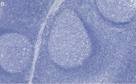 Anti-Rb Antibody, clone 2M15 ZooMAb® Rabbit Monoclonal recombinant, expressed in HEK 293 cells