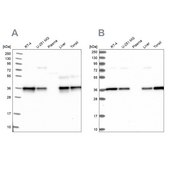 Anti-NUBP1 antibody produced in rabbit Prestige Antibodies® Powered by Atlas Antibodies, affinity isolated antibody, buffered aqueous glycerol solution
