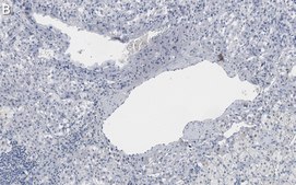 Anti-Clusterin α chain Antibody, clone 41D ZooMAb® Mouse Monoclonal recombinant, expressed in HEK 293 cells