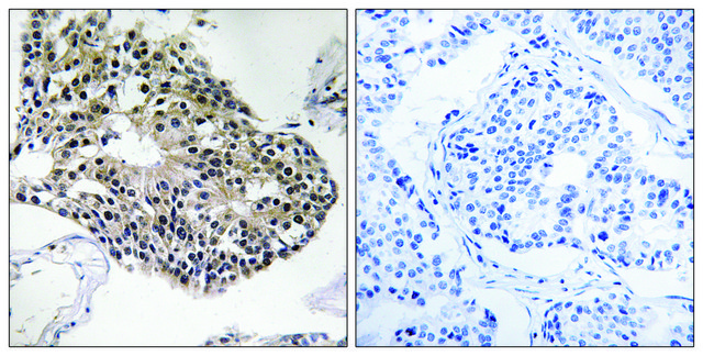 Anti-RPS25, C-Terminal antibody produced in rabbit affinity isolated antibody