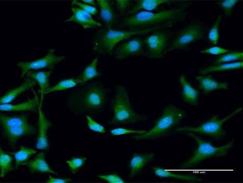 Anti-STX11 antibody produced in rabbit purified immunoglobulin, buffered aqueous solution