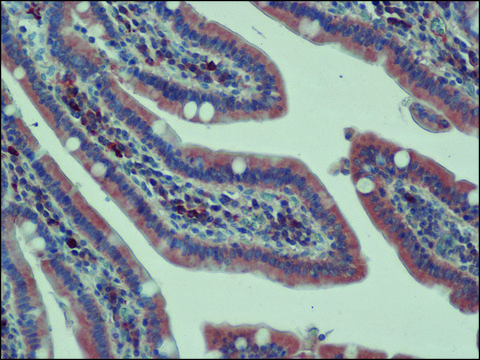 Anti-APC (C-terminal) antibody produced in rabbit ~1.0&#160;mg/mL, affinity isolated antibody