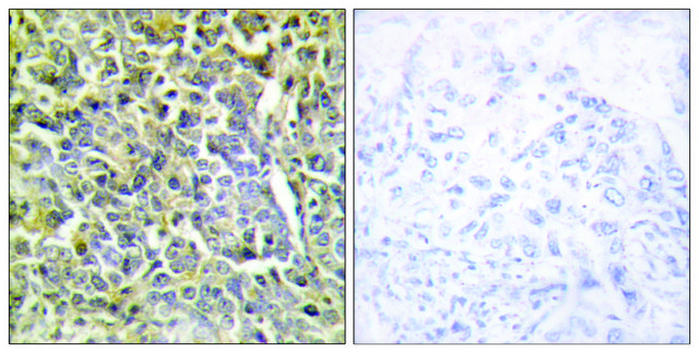 Anti-Collagen VI &#945;2 antibody produced in rabbit affinity isolated antibody