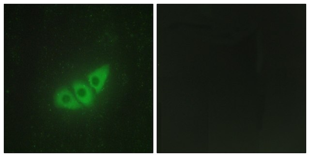 Anti-E2AK3 antibody produced in rabbit affinity isolated antibody