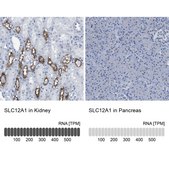 Anti-SLC12A1 antibody produced in rabbit Prestige Antibodies® Powered by Atlas Antibodies, affinity isolated antibody, buffered aqueous glycerol solution