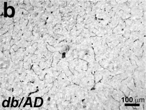 抗肌动蛋白，&#945;-平滑肌抗体，小鼠单克隆 clone 1A4, purified from hybridoma cell culture