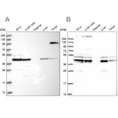Anti-SUCLA2 antibody produced in rabbit Prestige Antibodies® Powered by Atlas Antibodies, affinity isolated antibody