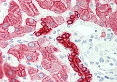 Anti-CRAT antibody produced in rabbit affinity isolated antibody