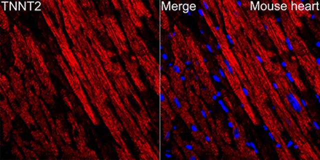 Anti-Cardiac troponin T (TNNT2) Antibody, clone 10H9D8, Rabbit Monoclonal