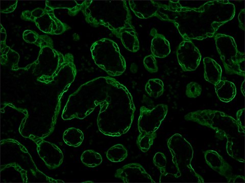 Monoclonal Anti-Cytokeratin Peptide 19 antibody produced in mouse clone A53-B/A2, tissue culture supernatant