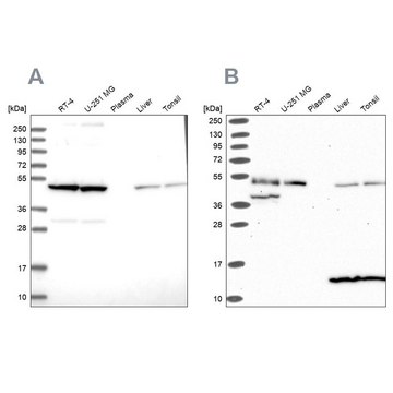 Anti-ST13 antibody produced in rabbit Prestige Antibodies&#174; Powered by Atlas Antibodies, affinity isolated antibody, buffered aqueous glycerol solution