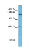 Anti-CASZ1 antibody produced in rabbit affinity isolated antibody