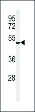 ANTI-OPN1MW (N-TERM) antibody produced in rabbit IgG fraction of antiserum, buffered aqueous solution