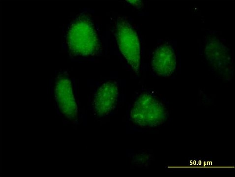 Anti-MLKL antibody produced in mouse purified immunoglobulin, buffered aqueous solution