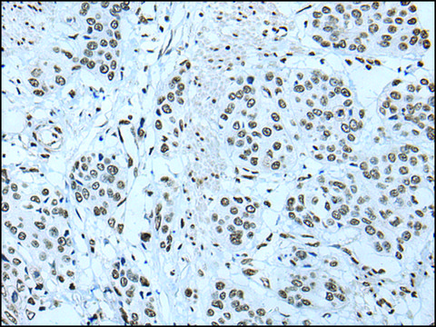 Anti-ZBTB4 affinity isolated antibody