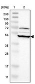 Anti-RNF130 antibody produced in rabbit Prestige Antibodies® Powered by Atlas Antibodies, affinity isolated antibody, buffered aqueous glycerol solution