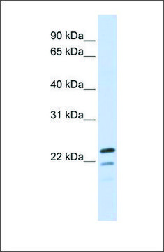 Anti-REEP1 antibody produced in rabbit affinity isolated antibody