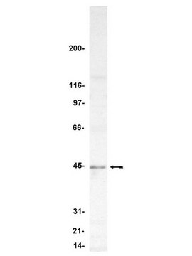 Anti-PP2A-methylesterase/PME-1 Antibody Upstate&#174;, from rabbit