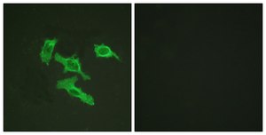 Anti-EGFR antibody produced in rabbit affinity isolated antibody