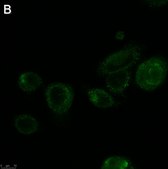 Anti-ALK-7 Antibody, clone 1N5 ZooMAb® Rabbit Monoclonal recombinant, expressed in HEK 293 cells