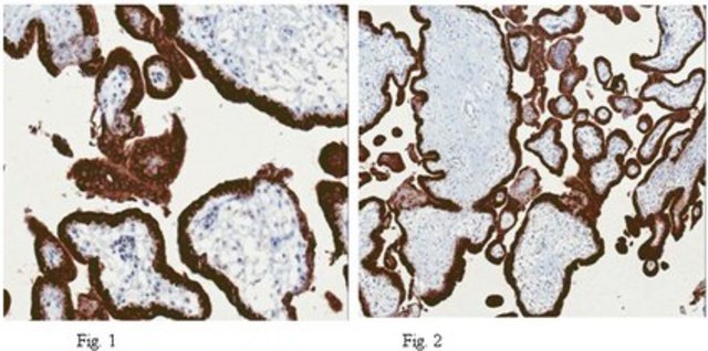 Anti-KiSS-1 Antibody, clone 8H4.1 clone 8H4.1, from mouse