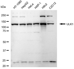 Anti ULK1 Antibody, clone 24GB2195, Rabbit Monoclonal clone 24GB2195, recombinant rabbit monoclonal, expressed in HEK293 cells