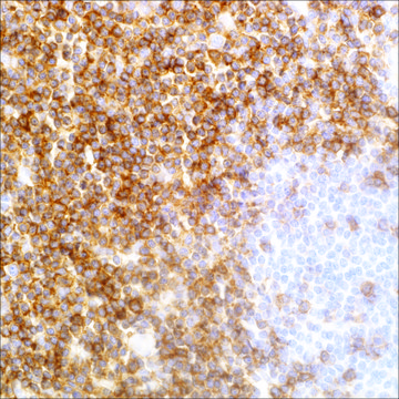 CD5 (EP77) Rabbit Monoclonal Primary Antibody