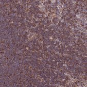 Anti-CDC25B antibody produced in rabbit Prestige Antibodies® Powered by Atlas Antibodies, affinity isolated antibody, buffered aqueous glycerol solution