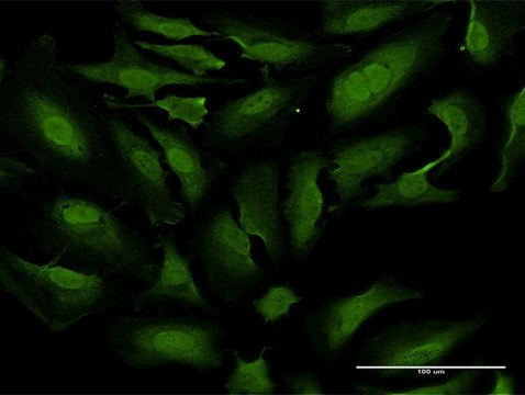 Monoclonal Anti-TKTL1 antibody produced in mouse clone 1D6, purified immunoglobulin, buffered aqueous solution