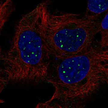 Anti-SBF1 antibody produced in rabbit Prestige Antibodies&#174; Powered by Atlas Antibodies, affinity isolated antibody