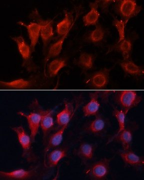 Anti-VEGF antibody produced in rabbit