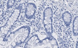 Anti-CMPK2 Antibody, clone 1M13 ZooMAb® Rabbit Monoclonal recombinant, expressed in HEK 293 cells