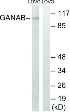 Anti-GANAB antibody produced in rabbit affinity isolated antibody