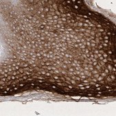 Anti-DMKN antibody produced in rabbit Prestige Antibodies® Powered by Atlas Antibodies, affinity isolated antibody, buffered aqueous glycerol solution