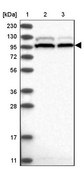 Anti-SRBD1 antibody produced in rabbit Prestige Antibodies® Powered by Atlas Antibodies, affinity isolated antibody, buffered aqueous glycerol solution, ab1