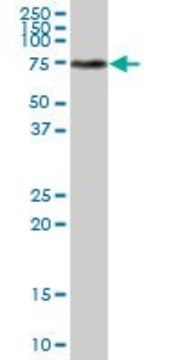 Anti-TKT antibody produced in mouse purified immunoglobulin, buffered aqueous solution