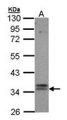 Anti-GPBAR1 (C-terminal) antibody produced in rabbit affinity isolated antibody, buffered aqueous solution