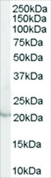 Anti-Lipocalin 2/NGAL (AB1) antibody produced in goat affinity isolated antibody, buffered aqueous solution