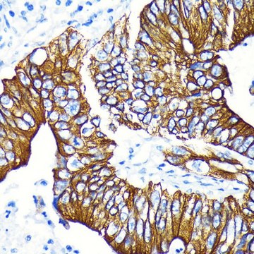 Anti-Phospho-GSK3&#946;-S9 antibody produced in rabbit