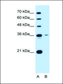Anti-TSPAN5 affinity isolated antibody