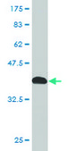 Monoclonal Anti-SNCB antibody produced in mouse clone 3G6, purified immunoglobulin, buffered aqueous solution