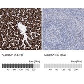 Anti-ALDH6A1 antibody produced in rabbit Prestige Antibodies® Powered by Atlas Antibodies, affinity isolated antibody, buffered aqueous glycerol solution, ab4