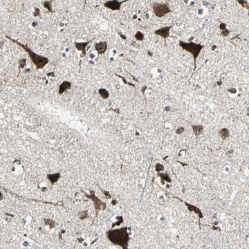 Anti-AATF antibody produced in rabbit Prestige Antibodies&#174; Powered by Atlas Antibodies, affinity isolated antibody, buffered aqueous glycerol solution