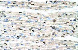 Anti-HNRPDL antibody produced in rabbit IgG fraction of antiserum