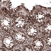 Monoclonal Anti-LAMP1 antibody produced in mouse Prestige Antibodies® Powered by Atlas Antibodies, clone CL4490, purified immunoglobulin